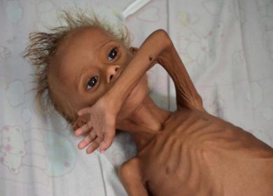 bambino yemenita