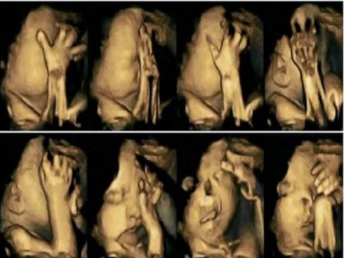 feto in pancia madre fumatrice
