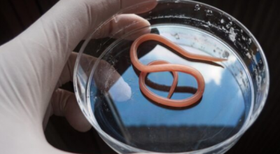 La svolta: un parassita intestinale potrebbe un giorno curare le malattie