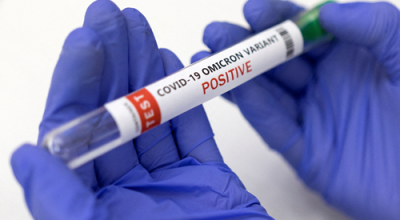 Long-Covid: i disturbi angoscianti del Covid prolungato tornano ad aumentare dopo 3 anni