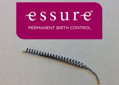 essure