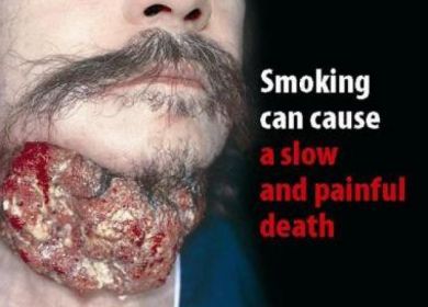 danni alla salute da fumo