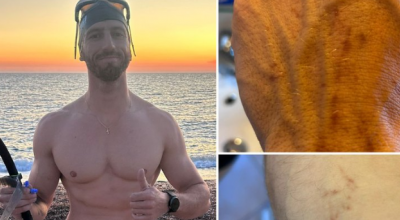 Un uomo è stato attaccato da uno squalo pinna nera durante le sue vacanze in Sardegna