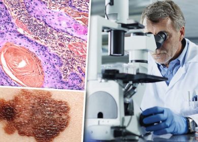 ricercatore cancro