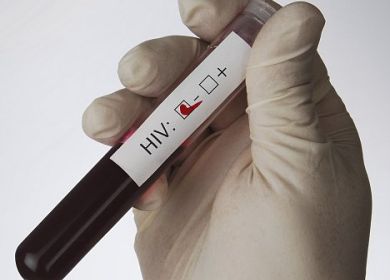 test  HIV