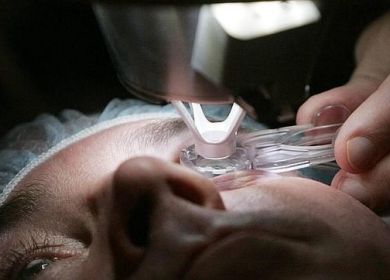 trapianto cornea