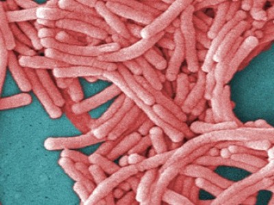 legionella