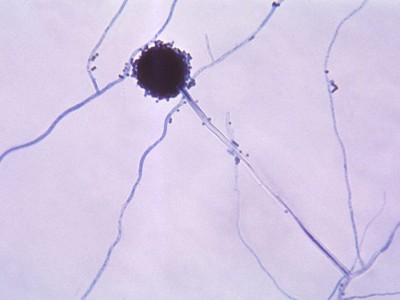 Aspergillus