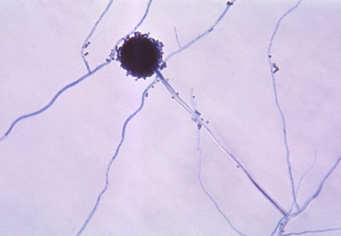 Aspergillus Aspergillus