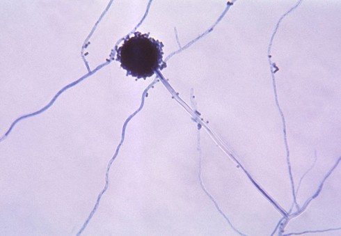 Aspergillus