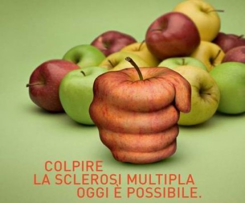 lotta alla sclrosi multipla lotta alla sclrosi multipla