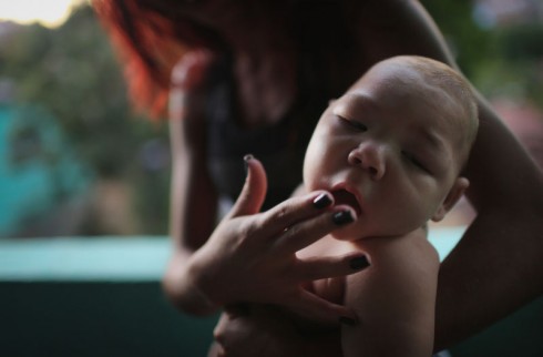 zika zika