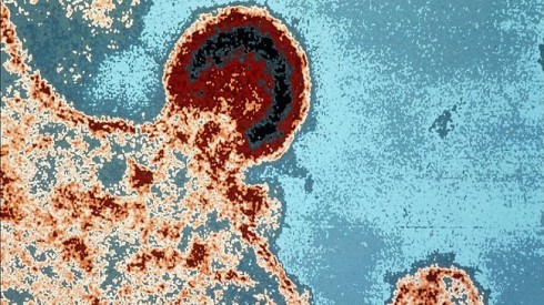 aids-virus-hiv aids-virus-hiv