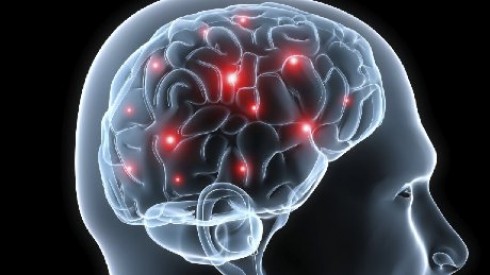 alzheimer alzheimer