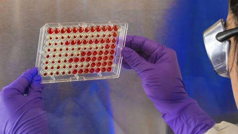 Covid "preoccupante" cosa può fare al sangue