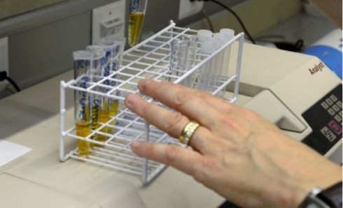 analisi urine analisi urine