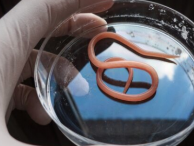 La svolta: un parassita intestinale potrebbe un giorno curare le malattie