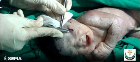 neonata siriana