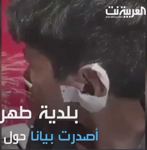 Orrore a Teheran: la municipalità taglia l'orecchio di un bambino che guarda nella spazzatura. 