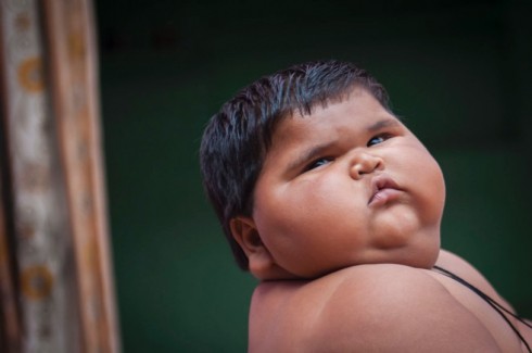 bambino obeso bambino obeso