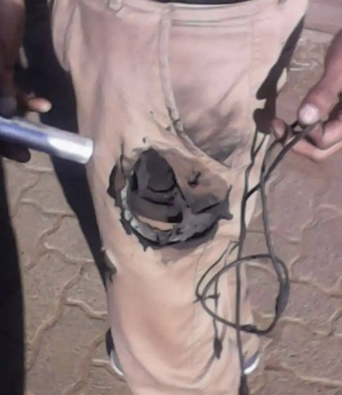 La batteria al litio esplode in tasca, passeggero ripota ustioni