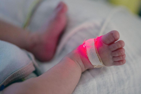 Bretagna: il mistero dei bambini "sans bras". Ad Ain e in Bretagna, i bambini nascono con questa malformazione.