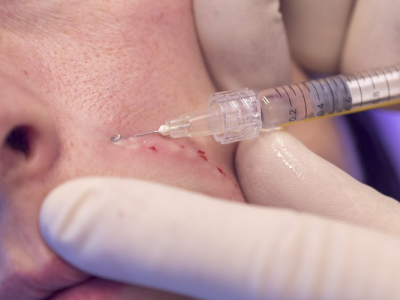 Una seduta di botox si trasforma in un incubo