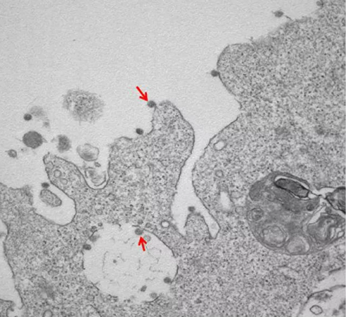 Presentate prime immagini al microscopio del ceppo italiano Sars-CoV-2.