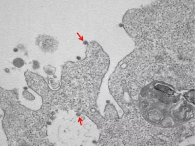 Presentate prime immagini al microscopio del ceppo italiano Sars-CoV-2. 