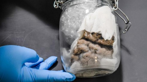Stati Uniti. Barattolo contenente un cervello umano sequestrato in dogana. 