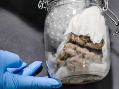 Stati Uniti. Barattolo contenente un cervello umano sequestrato in dogana. 
