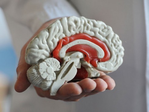 cervello modello