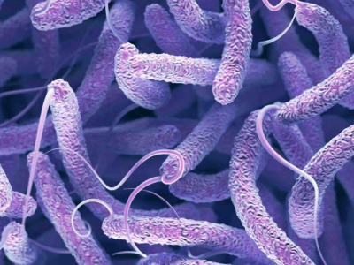 L'acqua santa contaminata dall'Etiopia ha portato il colera multiresistente in Europa