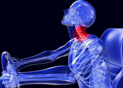 Altro “Stop” della Cassazione alle assicurazioni: risarcibili anche le lesioni non “strumentalmente accertate” come con le radiografie. 