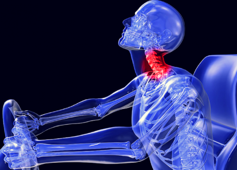 Altro “Stop” della Cassazione alle assicurazioni: risarcibili anche le lesioni non “strumentalmente accertate” come con le radiografie.