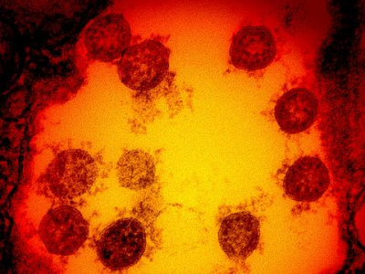 Scoperta nel Regno Unito una nuova variante di coronavirus: "Più facile da trasmettere".