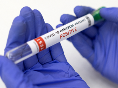 Long-Covid: i disturbi angoscianti del Covid prolungato tornano ad aumentare dopo 3 anni
