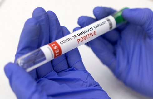 Long-Covid: i disturbi angoscianti del Covid prolungato tornano ad aumentare dopo 3 anni