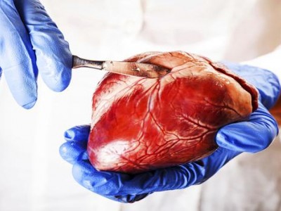 Ricerca scientifica:contro gli infarti un nuovo farmaco