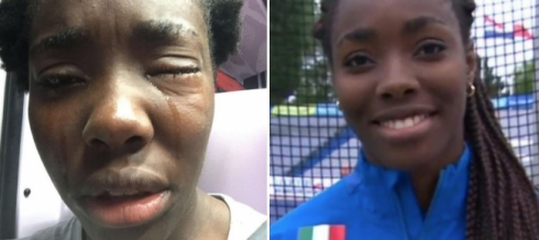 L'ignoranza non ha confini: uova in faccia a un'atleta italiana. La sua colpa? È nera!