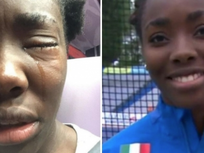 L'ignoranza non ha confini: uova in faccia a un'atleta italiana. La sua colpa? È nera!