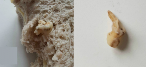 Coop di Basilea, trova un dente umano dentro il panino alle noci. 