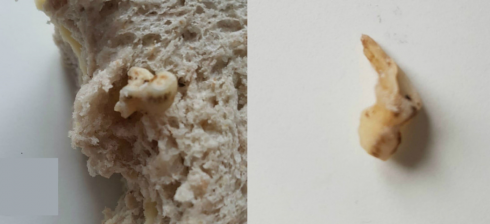 Coop di Basilea, trova un dente umano dentro il panino alle noci.
