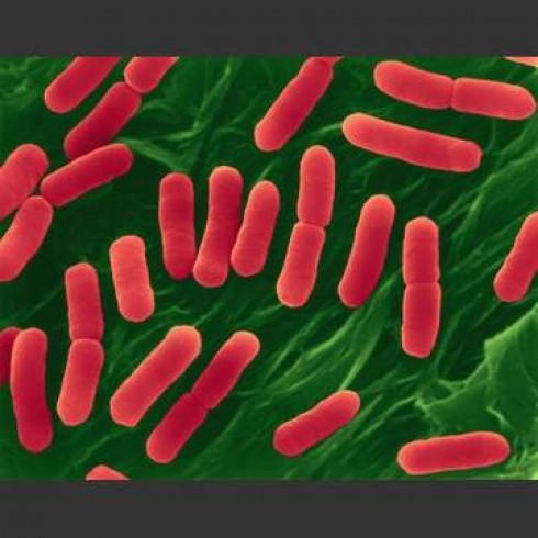 Escherichia coli Escherichia coli