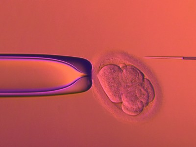 Bioetica: anche in Italia riconoscimento del nascituro all’anagrafe dopo la morte