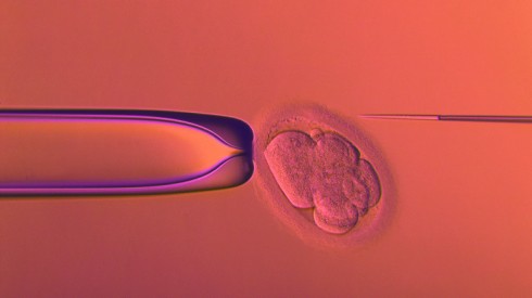 Bioetica: anche in Italia riconoscimento del nascituro all’anagrafe dopo la morte