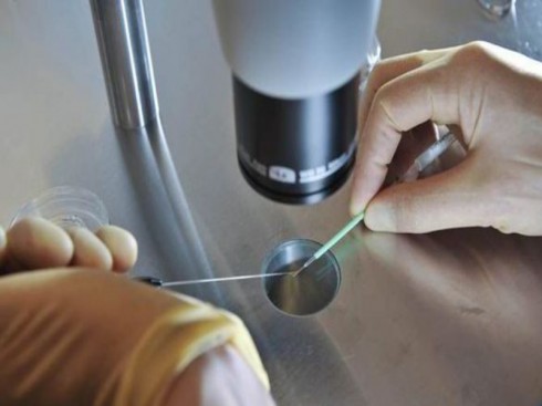 fecondazione in vitro fecondazione in vitro