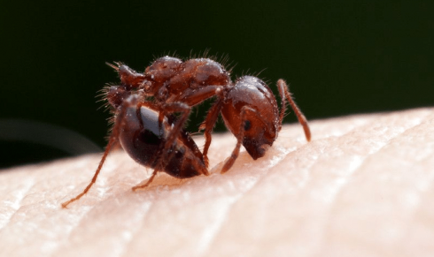 Shock allergico e negligenza medica: bambina muore per punture di formiche