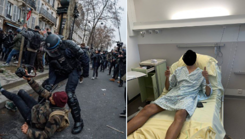 Manifestazione a Parigi: fotografo 26enne colpito con un manganello, gli è stato amputato un testicolo