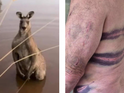 Australia, un uomo ha rischiato di morire dopo essere stato "frustato" selvaggiamente da un canguro